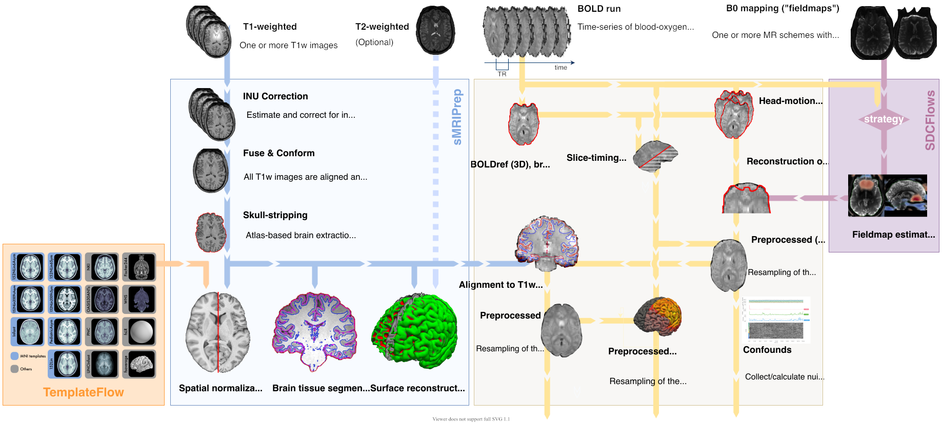 Neuroimaging Pipelines