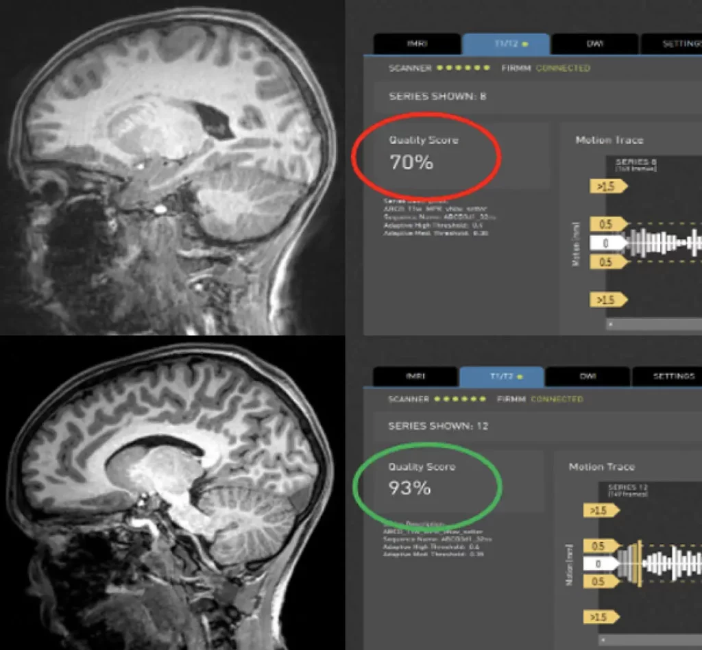 FIRMM: Real-time Head Motion Tracking